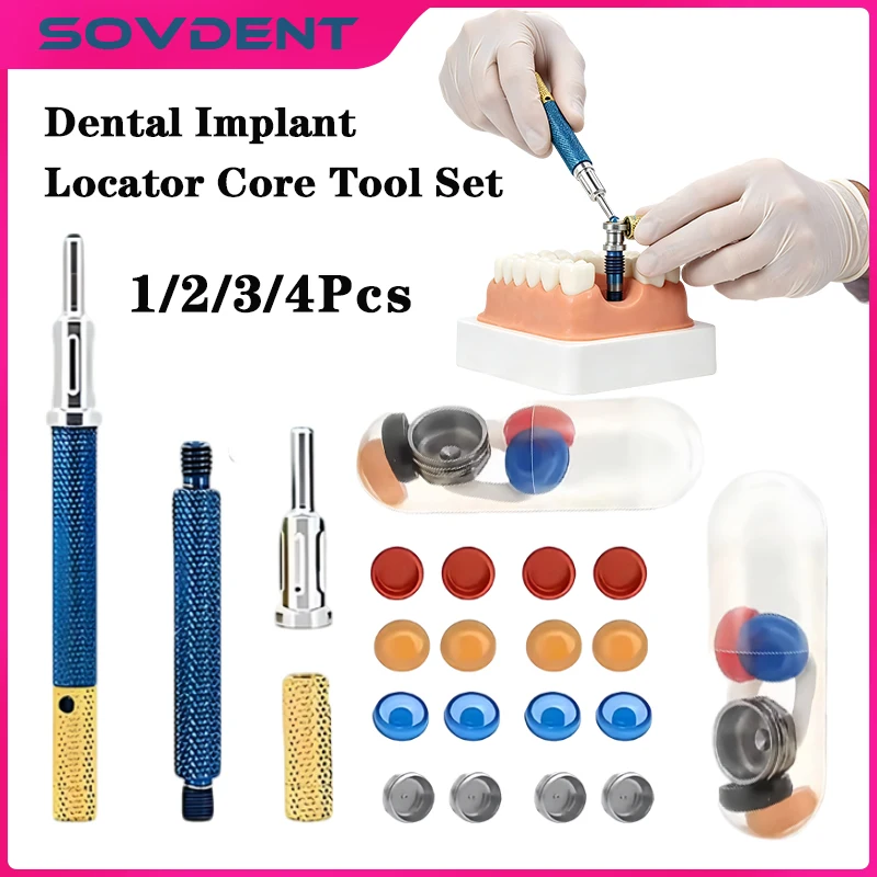 Dental Implant Retention Caps Removable Insertion Extraction Universal Locator Core Tool Abutment Overdenture Attachment Kit