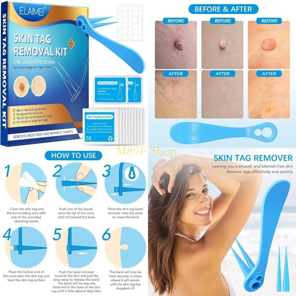 

M89F Skin Tag Remover Device for Small/Large Skin Tags Removal Bands & Cleaning Wipe