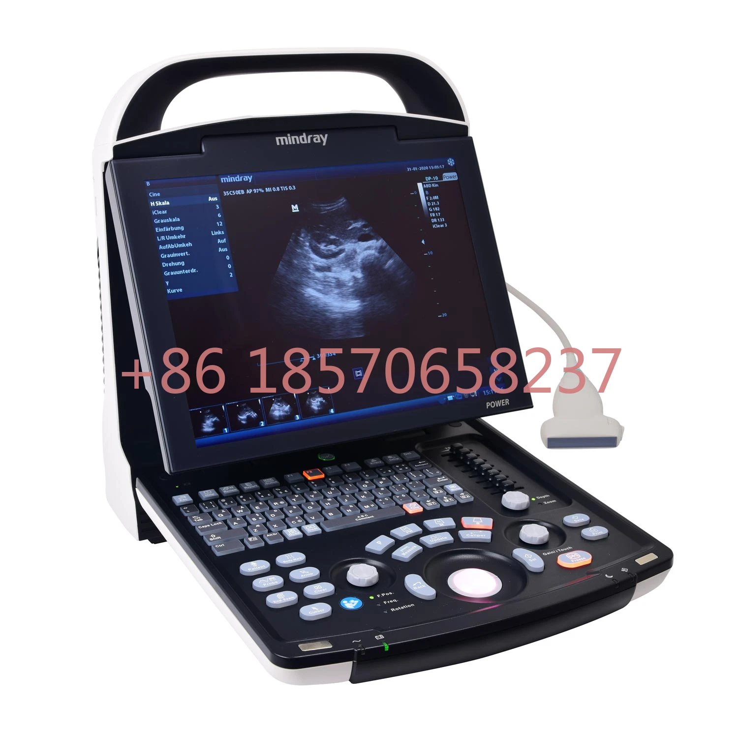 Medical Ultrasound Instruments Diagnostic Imaging System Full digital Mindray dp 30 ultrasound machine with Trolley