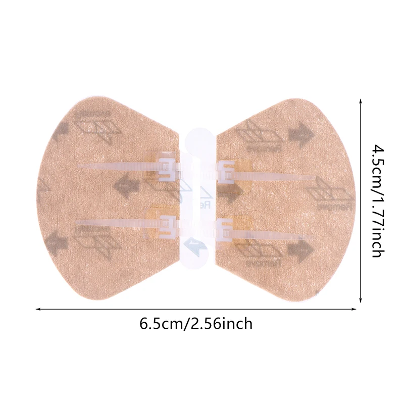 2 pezzi cerniera cravatta chiusura della ferita cerotto cerniera cerotto ferita sutura veloce cerotti emostatici portatili all'aperto strumento di primo soccorso