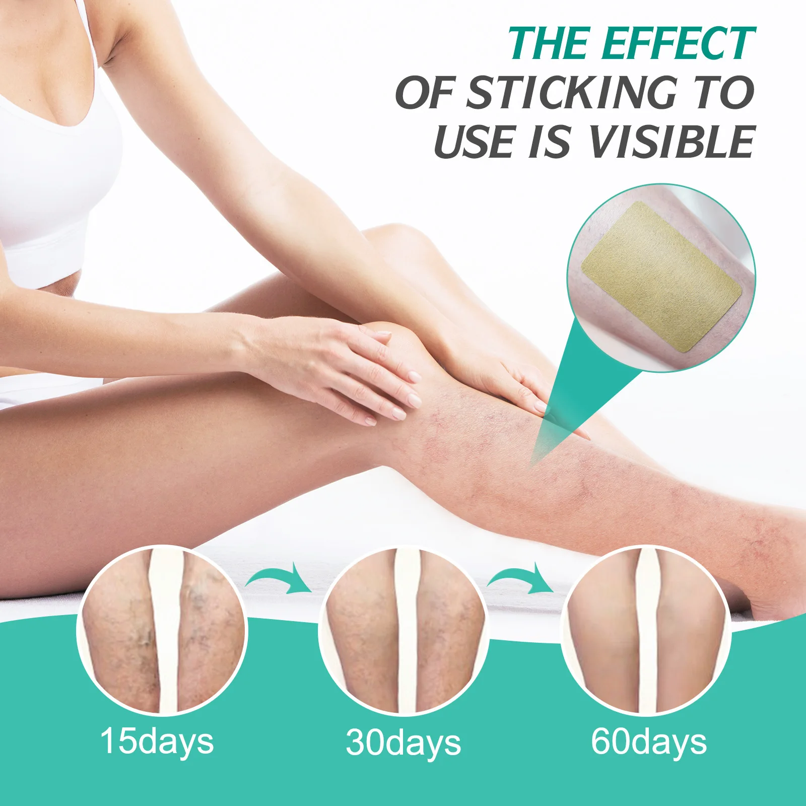 Patch de traitement des varices, plâtre pour les maux de jambes, favorise le métabolisme, favorise la Circulation sanguine lisse, 8 pièces