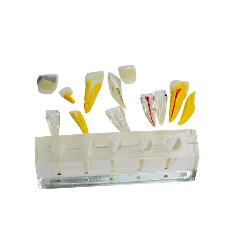 

Модель для демонстрации и практики лечения корневых каналов: 5 передних зубов, кристаллическая модель, имитация полости рта