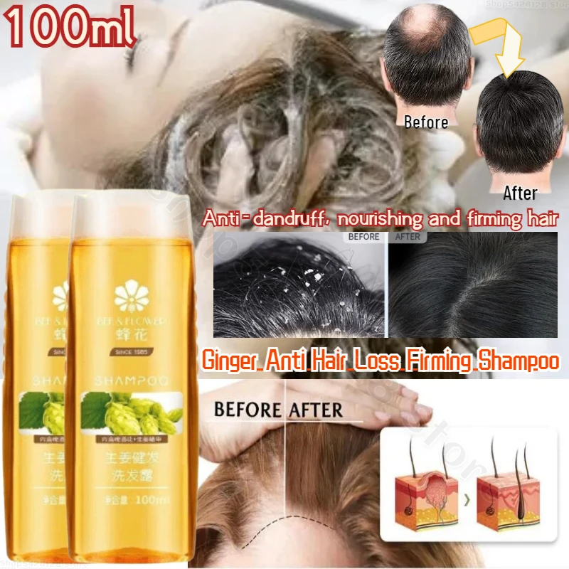 

Bee Flower Promotes Hair Growth Repairs Ginger Shampoo 100ml Repairs Damaged Hair Follicles Fixes and Prevents Hair Loss