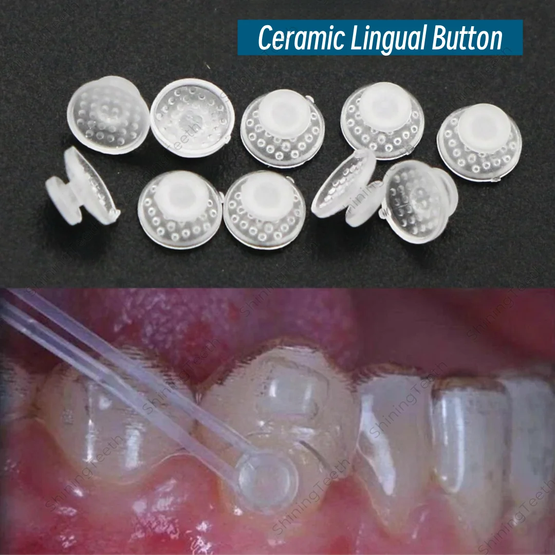 

Стоматологическая эстетическая прозрачная керамическая лингвальная кнопка, склеиваемая круглая ортодонтическая насадка, стоматологические инструменты