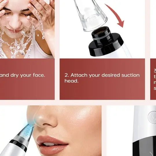 Máquina eliminadora de espinillas, cuidado de la piel, vacío de poros, eliminación de acné y espinillas, herramienta de succión, limpieza Facial, instrumento de belleza para el hogar