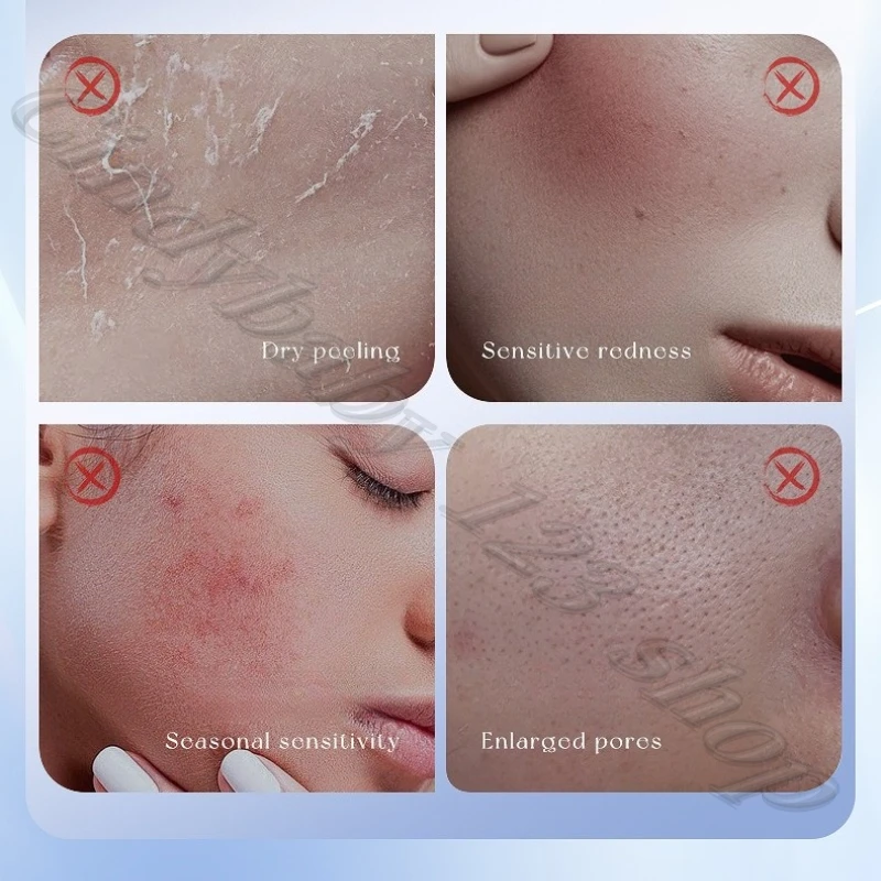 เอสเซนส์ทองคำ 24k ผสมไฮยาลูรอนนิค แอซิด ไนอะซินาไมด์ ช่วยเติมความชุ่มชื้น ลดเลือนริ้วรอย ขนาด 40 มล.