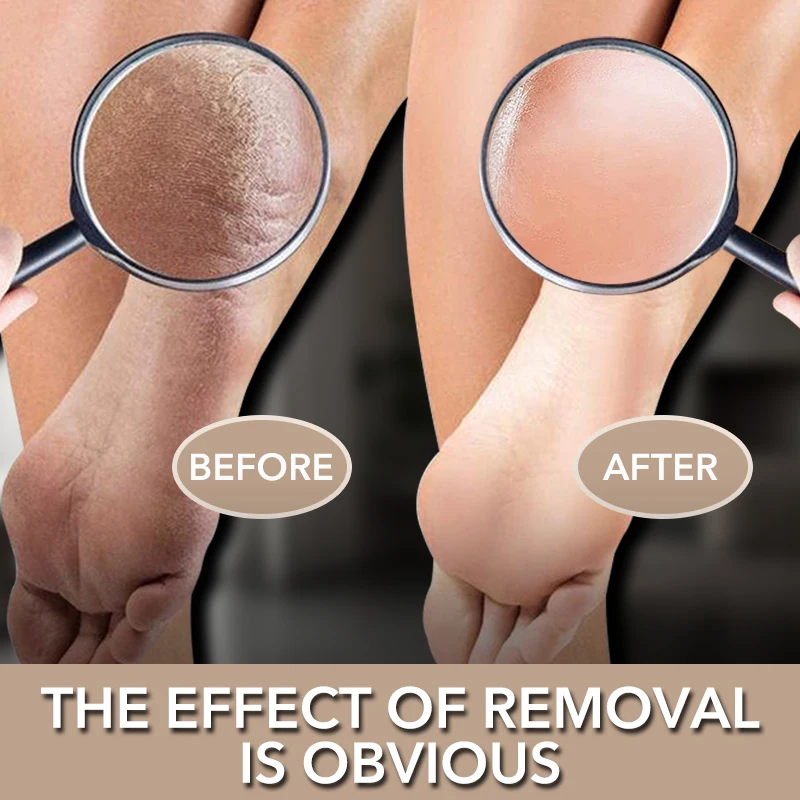 2Pc Glass Foot File Callus Remover Heel Dead Skin Care Removal Professional Manicure Pedicure Tools Dropshipping