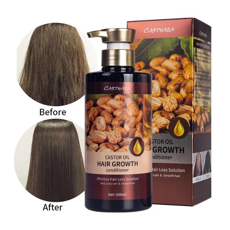 500ml Jamaica Castor Oil Shampoo Conditioner Anti-Hair Loss Thickening for Hair Regrowth,anti-thinning Hair Care Men and Women