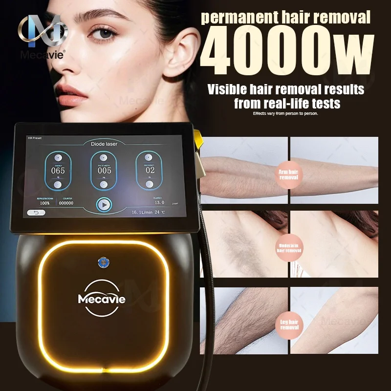 

4000 Вт лазерная 4-волновая 808/755/940/1064 нм диодное охлаждение безболезненное постоянное удаление волос для быстрой и удобного домашнего косметического инструмента