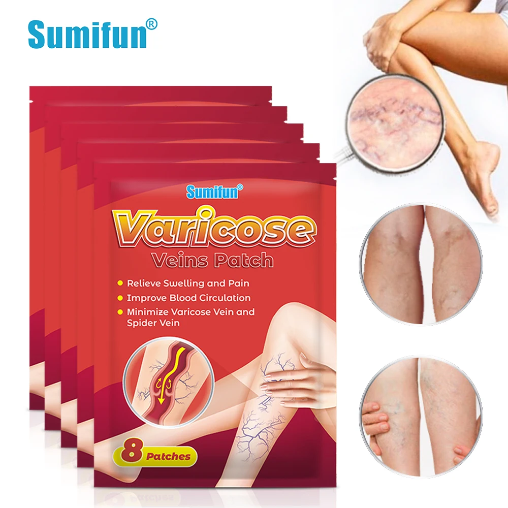 

8/40Pcs Sumifun Varicose Veins Patch Feet Leg Body Spider Shape Varicose Removal Varicosity Angiitis Sticker Phlebitis Plaster