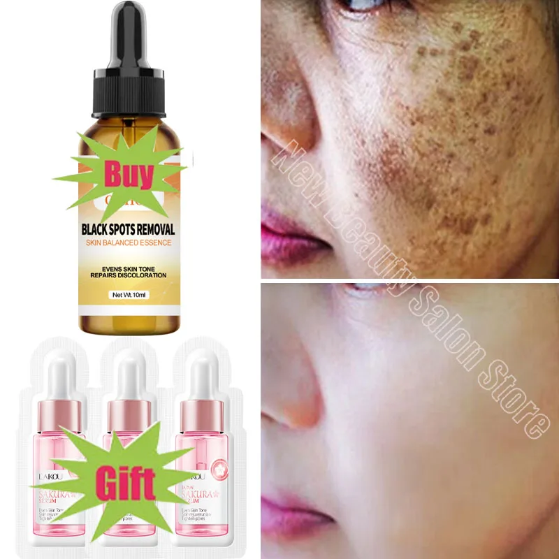 

Powerful Spot-removing Whiten Essence Brighten Skin Fast Eliminates Melanin Pigmentation Melasma Dark Spots Korean Skin Care