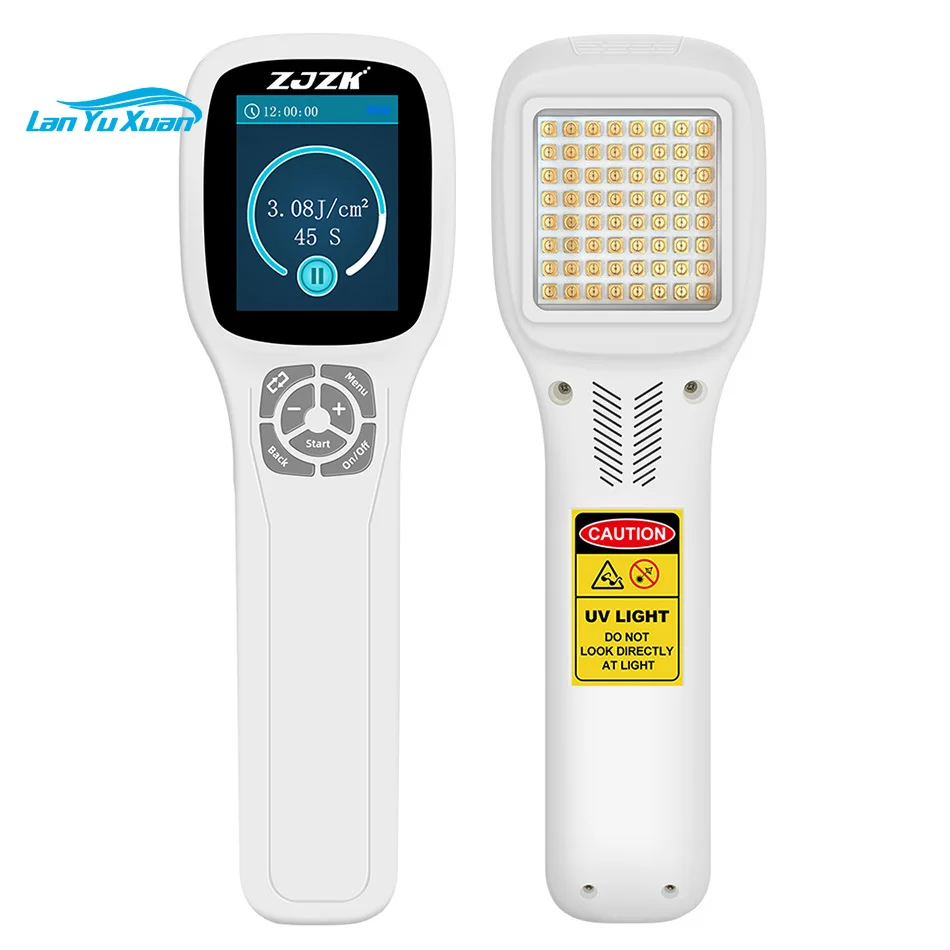 

Home Use 308nm Excimer Phototherapy UVB Therapy Device Treatment for Psoriasis and Other Skin Diseases