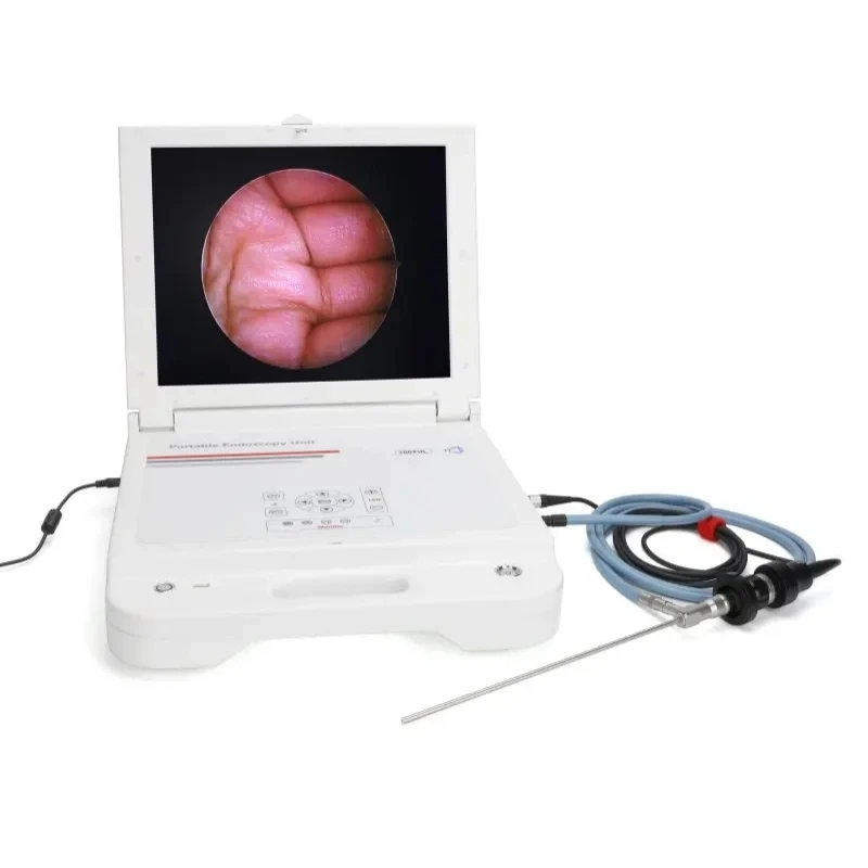 Fast Delivery Endoscope CCD Camera With Light Source and Portable Endoscopic Camera for ENT Surgery