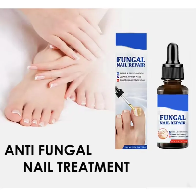 Huile de champignon des ongles, adoucit l'huile de traitement des ongles pour les ongles fragiles et fendus, produit de haute qualité