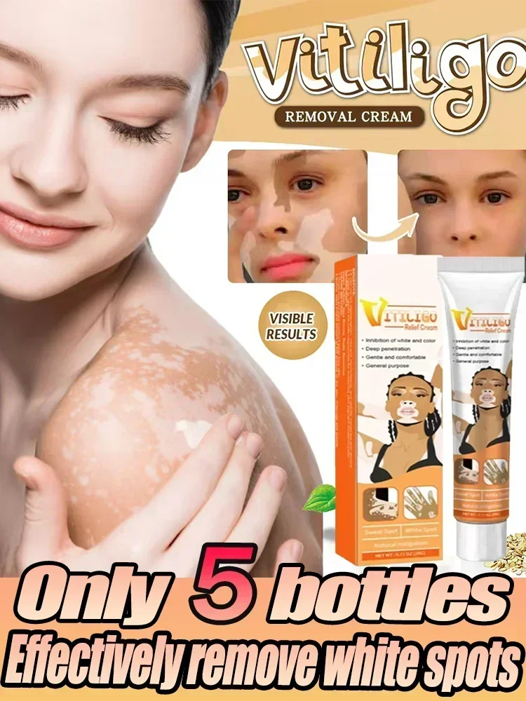 Ungüento de Vitiligo para eliminar eficazmente las manchas blancas de la piel, pomada para eliminar el Vitiligo, cuidado de la piel, 1006