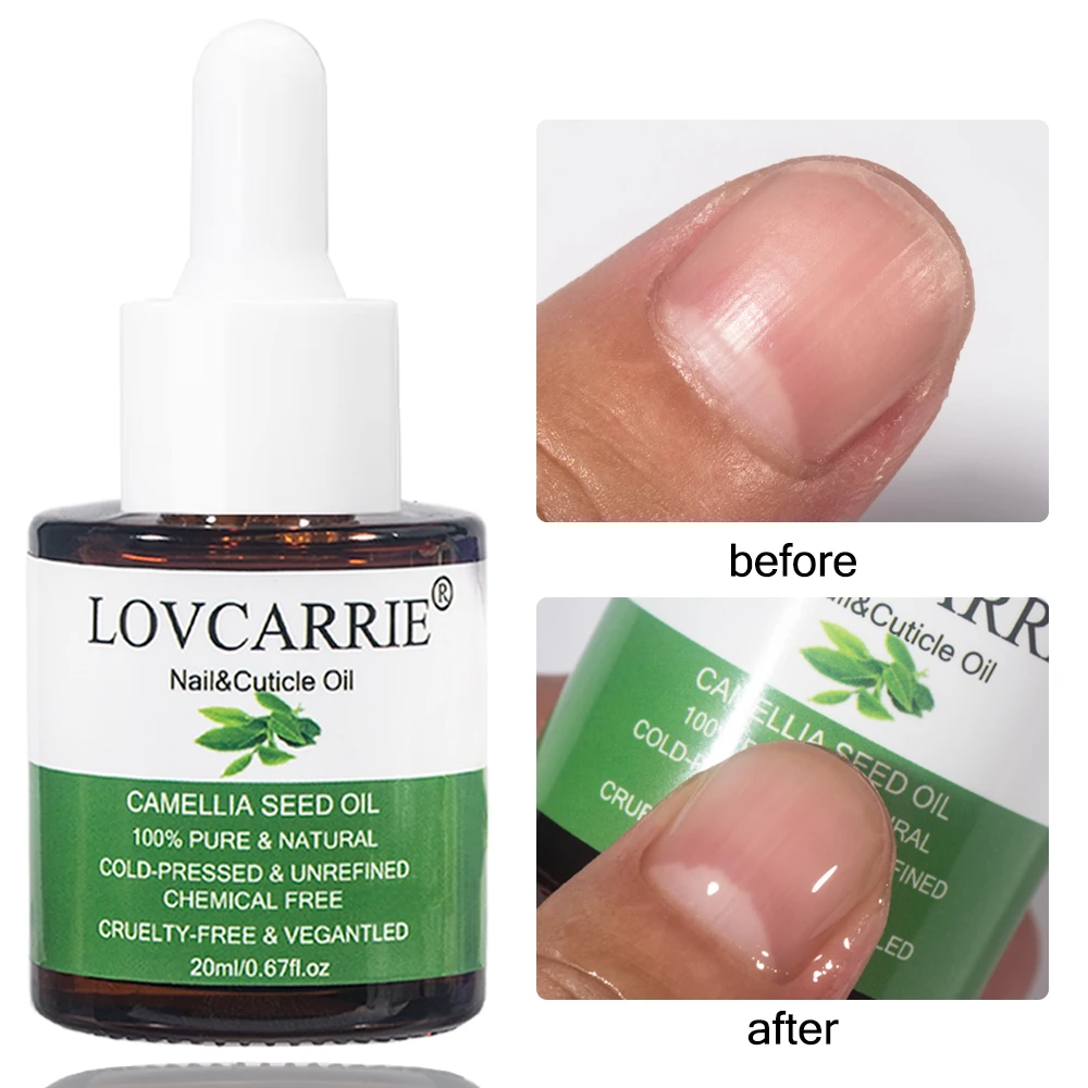 Lovcarrie Cuticula Olie Voor Nagels Kunstbehandeling 20Ml Voedingsformule Proteïne Nagel Reparatie Etherische Olie Serum Voedingshulpmiddelen