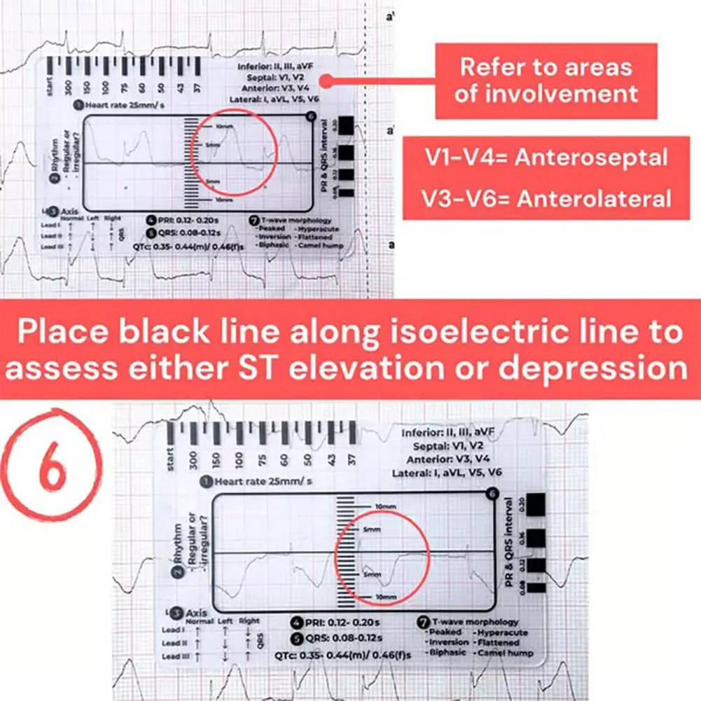 1 Set Transparent 7-Step Ruler Measuring Tool Compact Portable ECG-Interpretation Pocket Reference Guide Assessment Tool