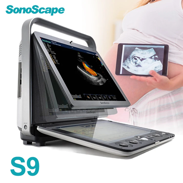 Products subject to negotiationNEW!! Factory Price Portable SonoscapeS9 Color Doppler Ultrasound with Auto&Portable Color Dopple