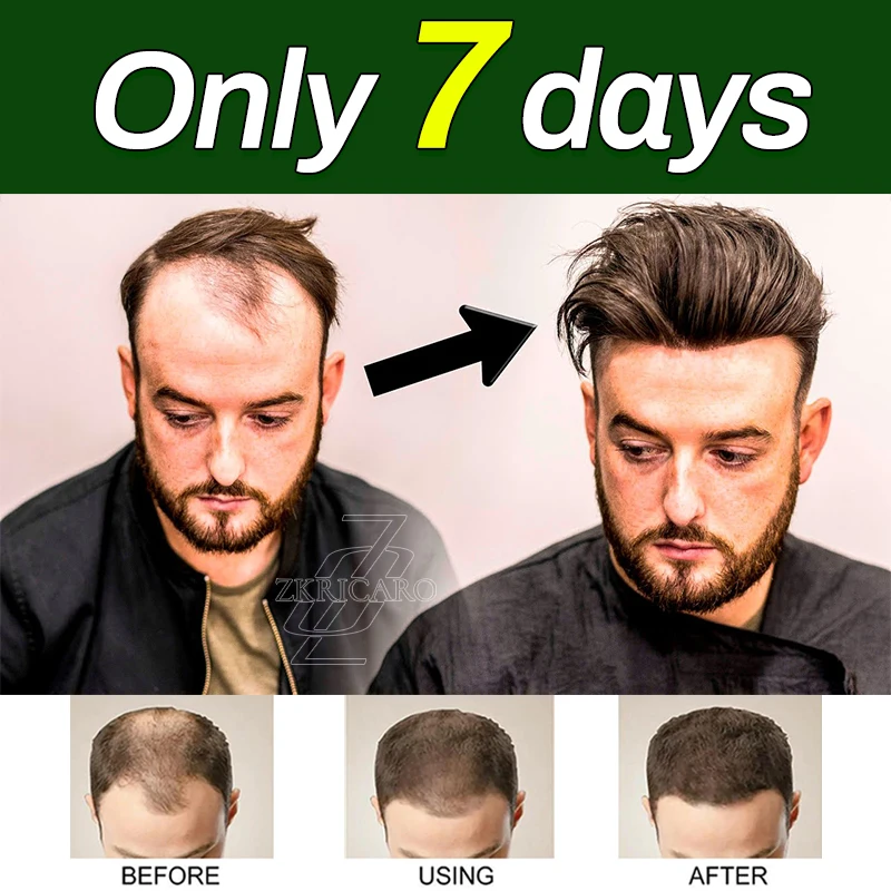 

Spray it daily to grow thicker hair and say goodbye to thinning hair