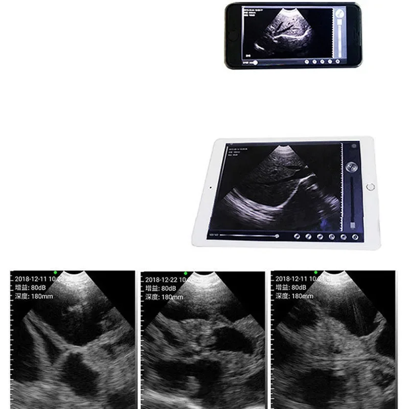 64Electronics Scanner veterinário sem fio portátil gravidez ultrassom portátil porco ovelhas