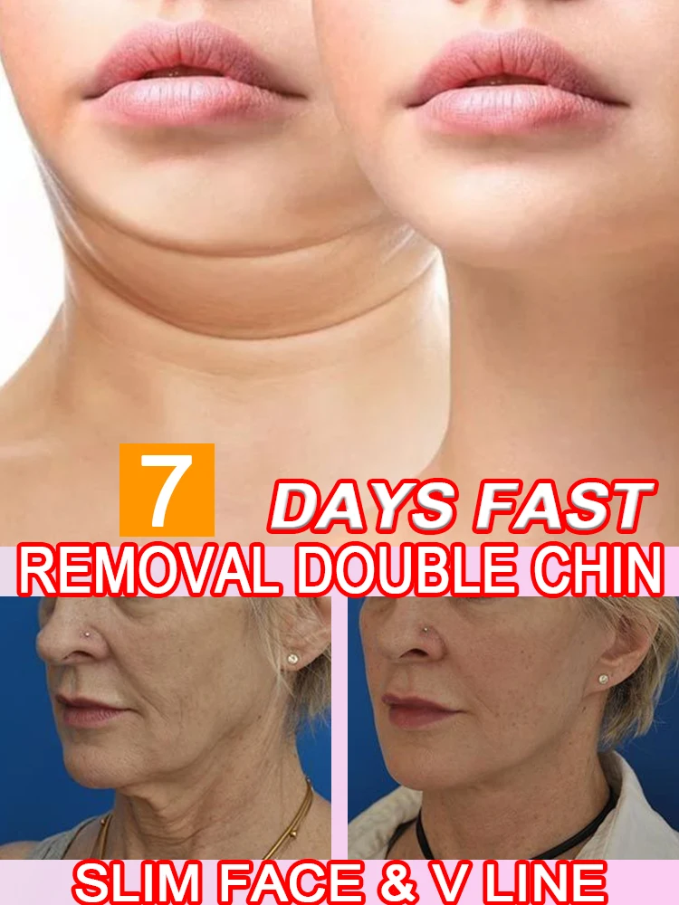 Face Slimming Cream Artifact Products V Line Face Slimming Double Chin Eliminate Slimming the Face