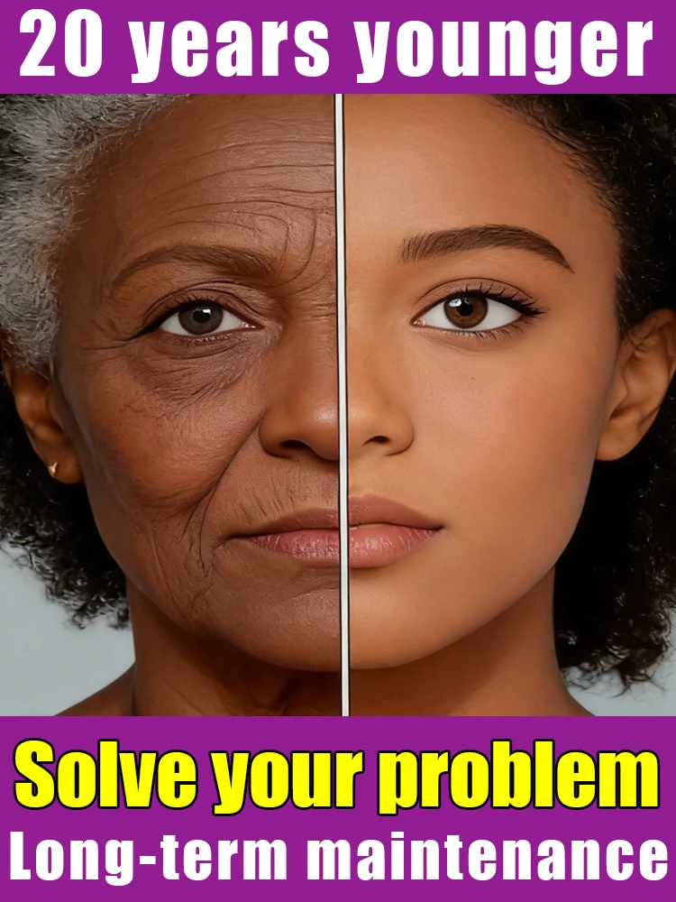 Generation-2 Popular Choice From wrinkles age-preventive free shipping