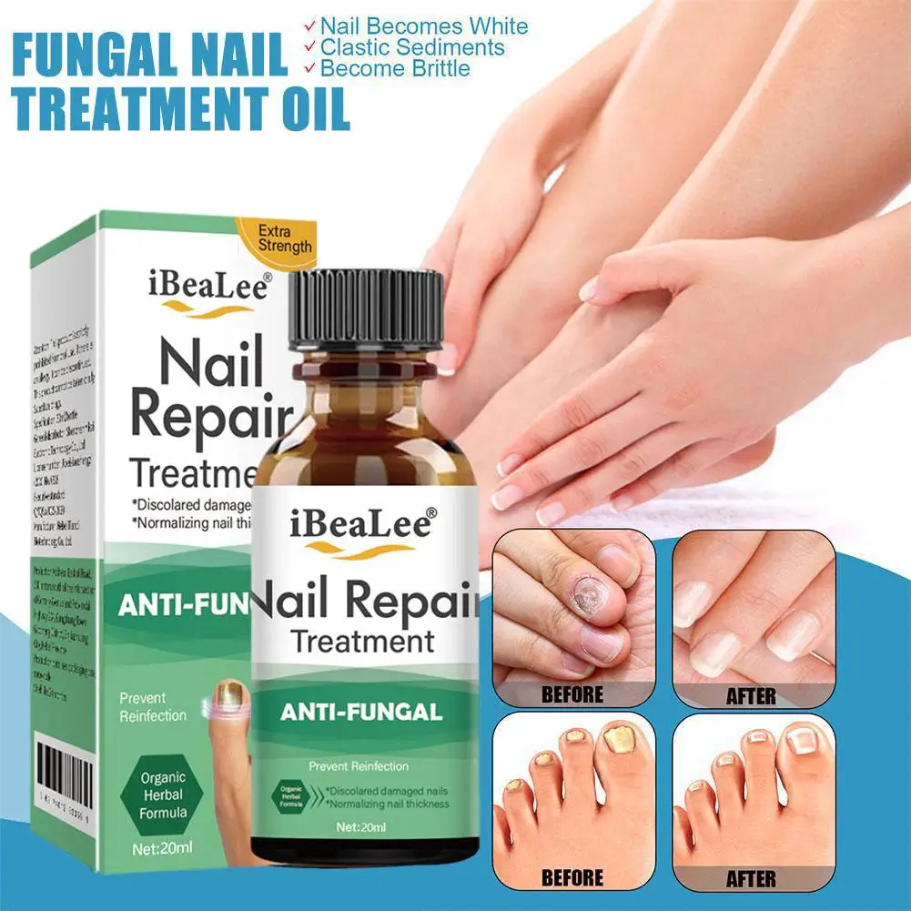 20ml Nail Solution Hand And Foot Thickening Type Gray Nail Gray Solution Nail Nail Cleaning Solution Nail Bright Soft U3V2