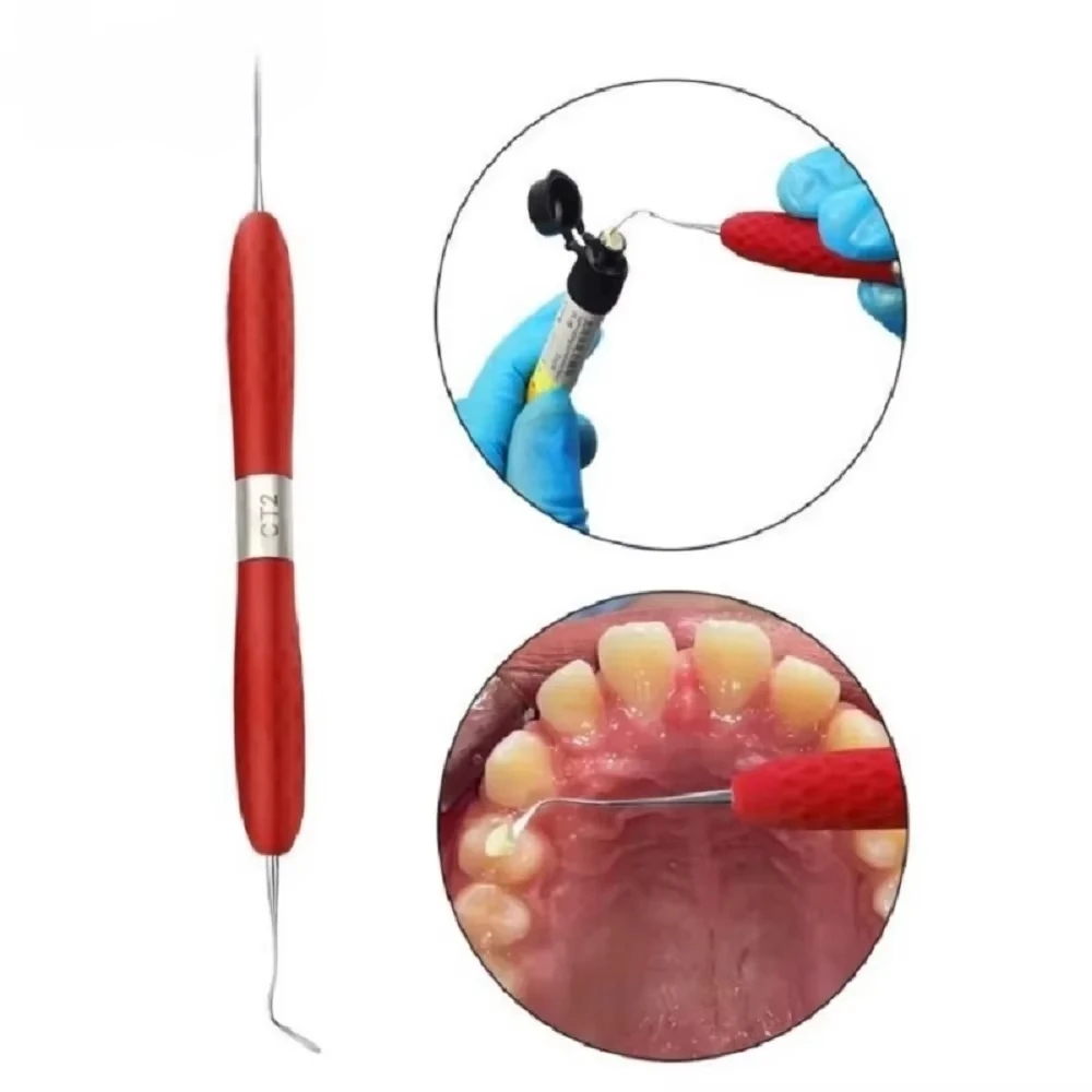 NIGF الأسنان الراتنج حشو الجمالية استعادة عدة مقبض سيليكون ل الراتنج سكين البلاستيك مضمد طب الأسنان أداة أداة