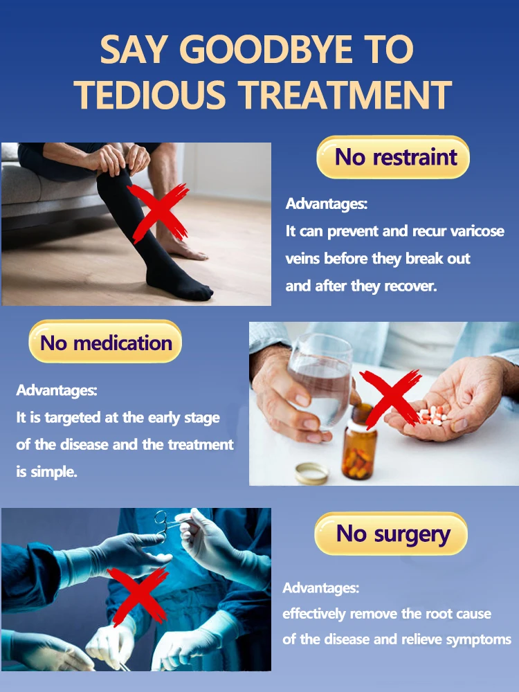 Eliminate vasculitis, phlebitis, relieve spider leg pain, varicose veins painless treatment view 5