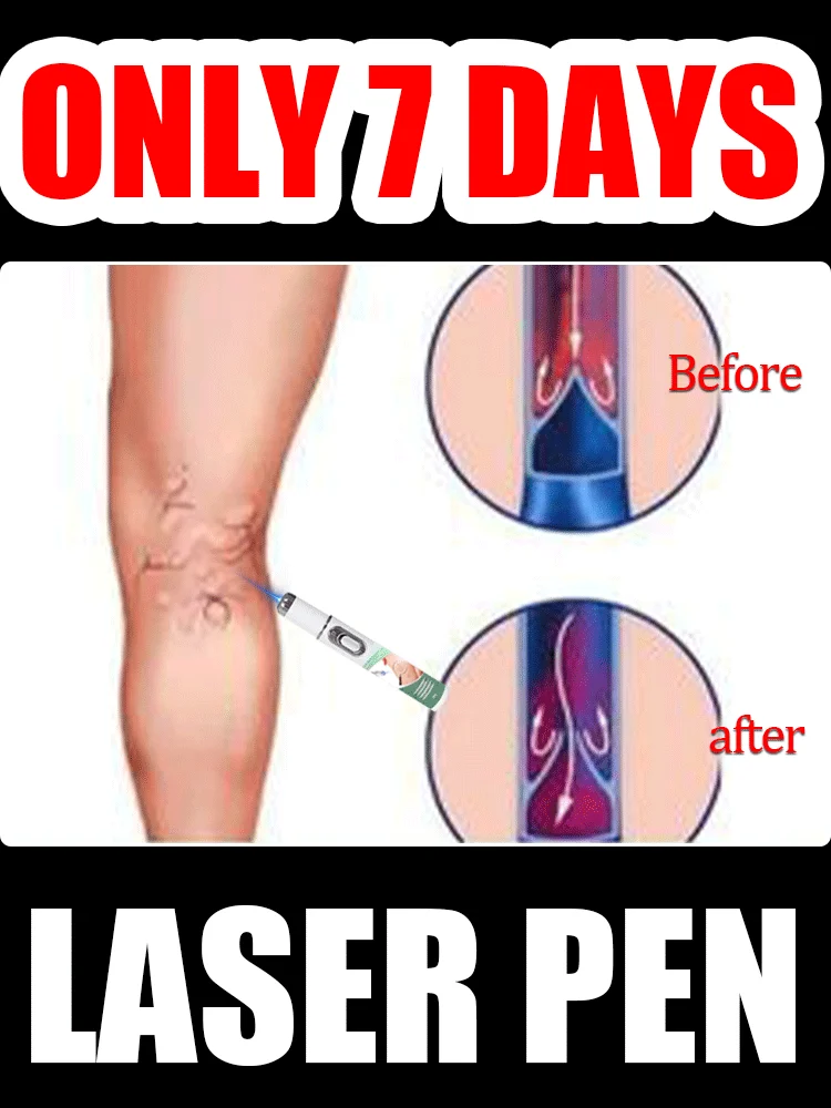

Leg vein repair light, leg vein patch, deformed and damaged, body care, 2025