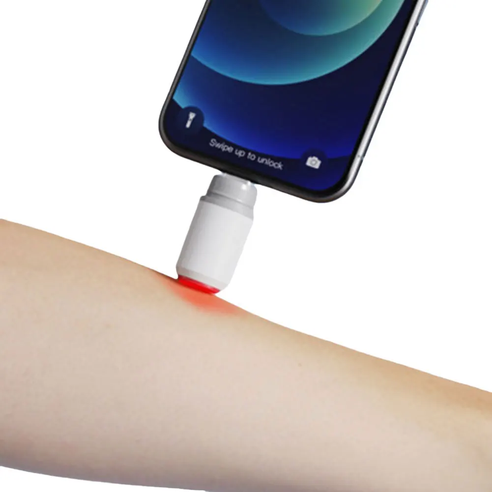 

Портативная ручка от укусов комаров и насекомых, снимающая зуд, без химикатов, терморучка от укусов комаров, ручка против зуда для кемпинга, путешествий на открытом воздухе