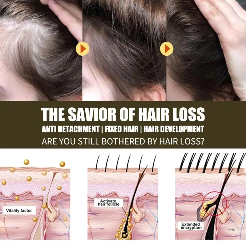 EELHOE-productos para el crecimiento del cabello para mujeres, esencia de romero, aceite esencial de rebrote rápido, hidratante multiefecto, cuidado del cabello grueso