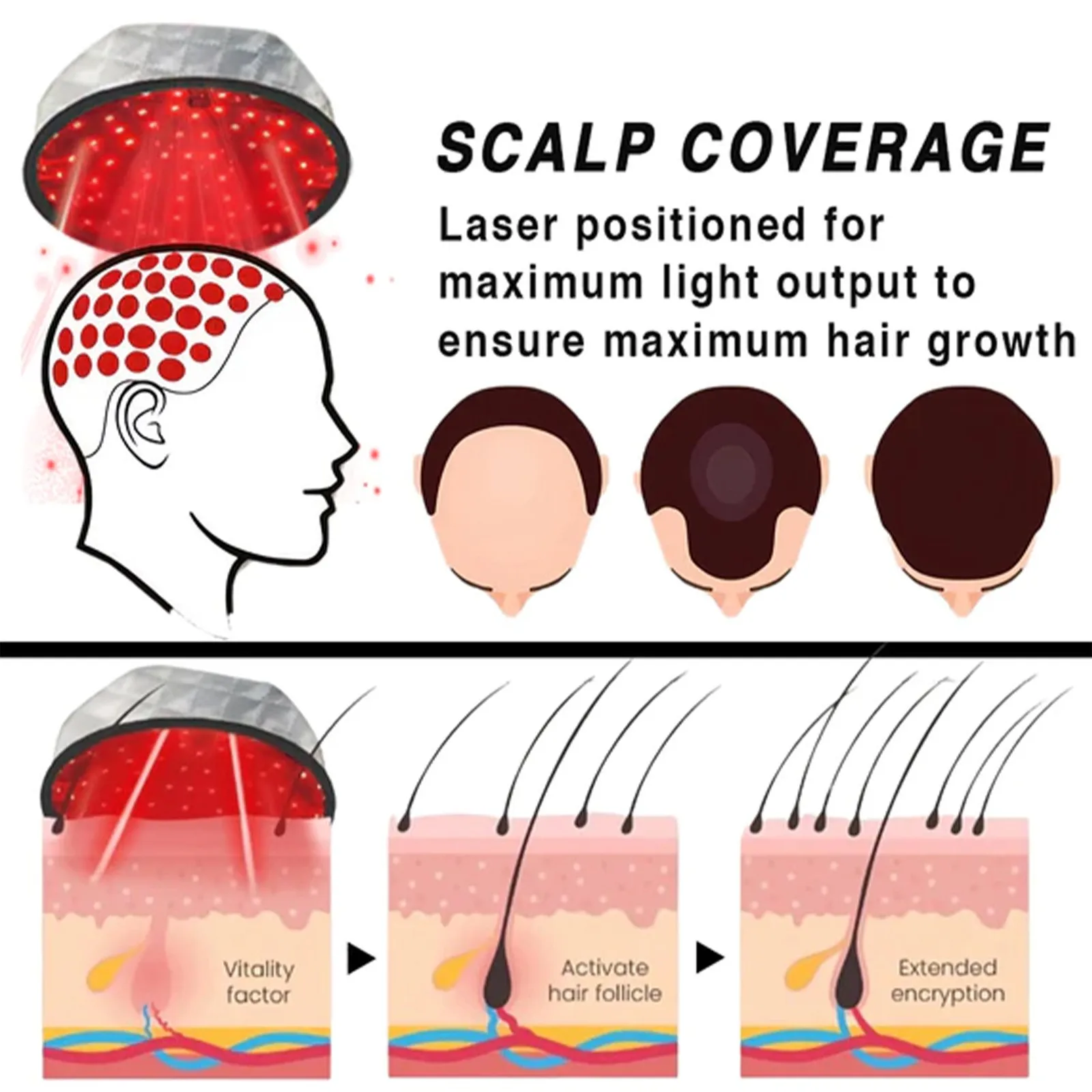 Hoegoa dense hair care cap 1PC soft dense hair scalp care heating massage cap mobile hair growth cap temperature adjustable