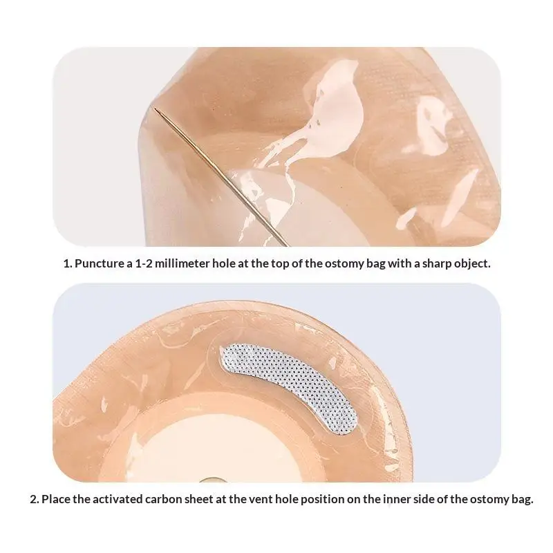 Disposable Leakproof Stoma Care Bags Carbon Filter Odor Absorb Deodorize 1/5/10Pcs for Postoperative Recovery Period