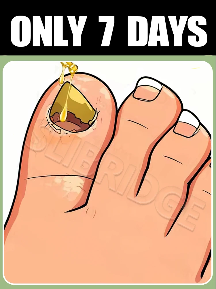 

2025Free shipping,Restore your nails' natural shine in 7 days