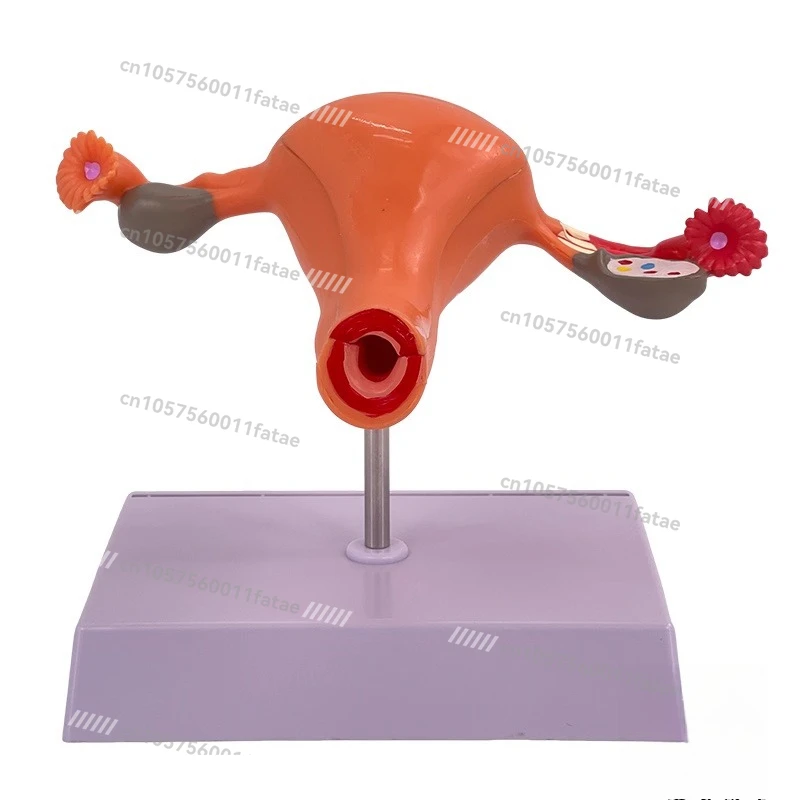 

Female Reproductive Uterus Model Ovarian Pathological Changes Pelvic Pelvic Sagittal Perineum Pelvic Floor Muscle Teaching Mold