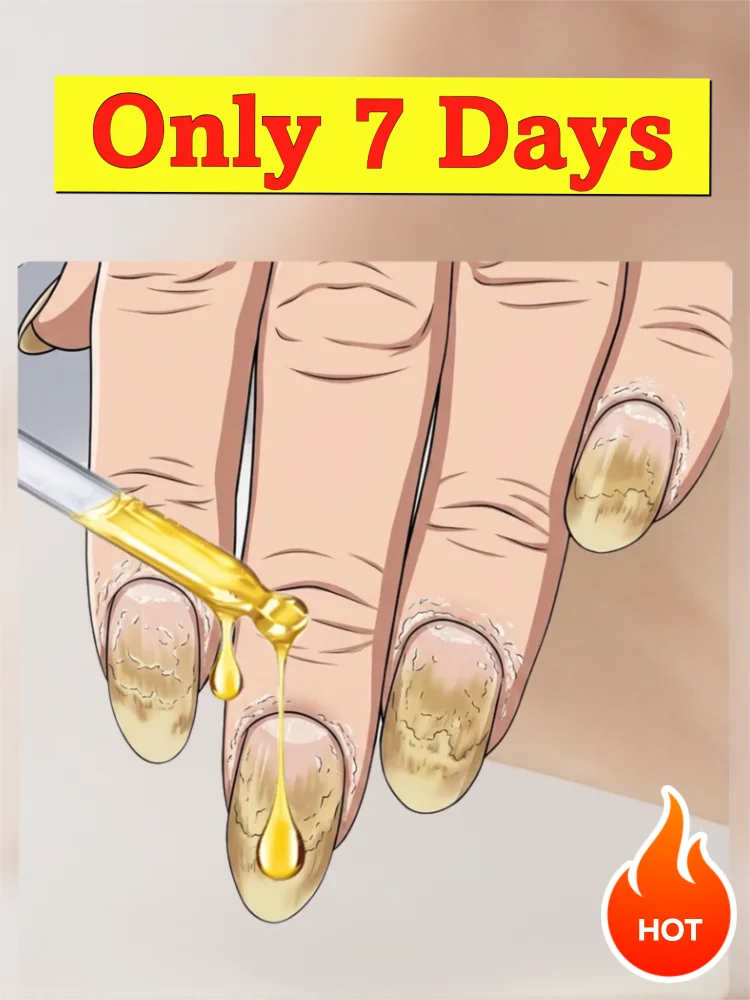 

Natural plant extracts，Easily Penetrates, Cleans Thoroughly, removes toenail fungus，quickly restores shine