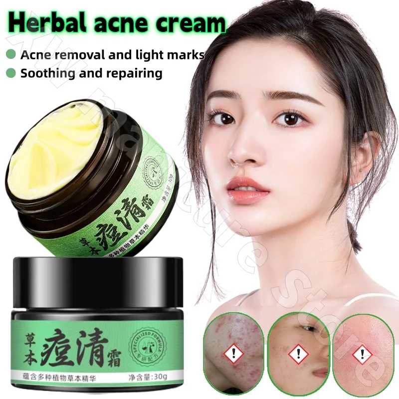 Strong Herbal Acne Cream Fades Acne Marks Moisturizing and Repairing Balanced Water Oil Herbal Plant Extract Essence 30g