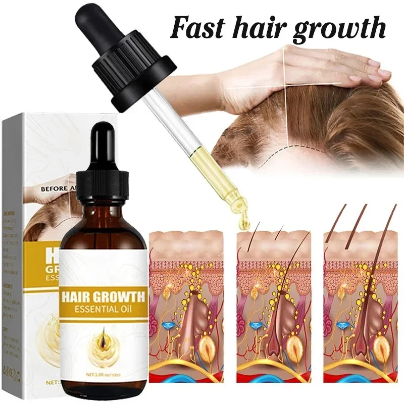 Hair Growth Essential Loss Regrowth Treatment เสริมสร้างเส้นผมบํารุงหนังศีรษะน้ําหนักเบาไม่เหนียวเหนอะหนะปรับปรุงการไหลเวียนของหนังศีรษะ