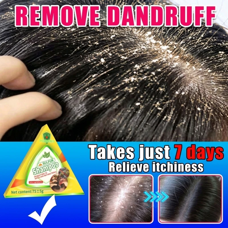 Maximum Strength Herbal Anti-Hair Loss Shampoo Bar Deep Scalp Detox Unclog Follicles Fast Hair Regrowth Treatment Severe Anti-Dandruff Itch Relief Solid Soap Stop Thinning Hair Clarifying Flake-Free Scalp Care For Men Women