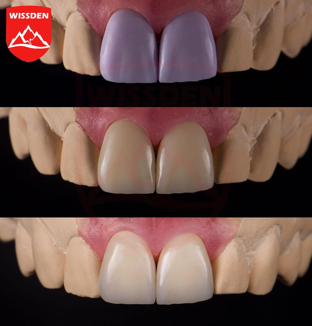 10 piezas Bloques de disilicato de litio ensanchados, cubos de cerámica de vidrio Dental C14, CAD/CAM,