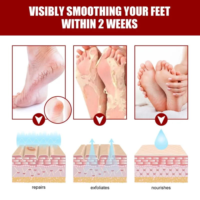 5pairs Exfoliating Foot Mask Foot SPA Pedicure Socks Removing Dead Skin Whitening Heels Feet Peeling Anti Cracked Foot Skin Care