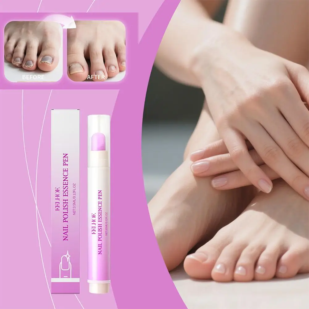 Nail Infection Repair Pen Anti Onychomycosis Paronychia Nail Fungus Removal Improve Toenail Discolored Yellowing Nail Care Pen