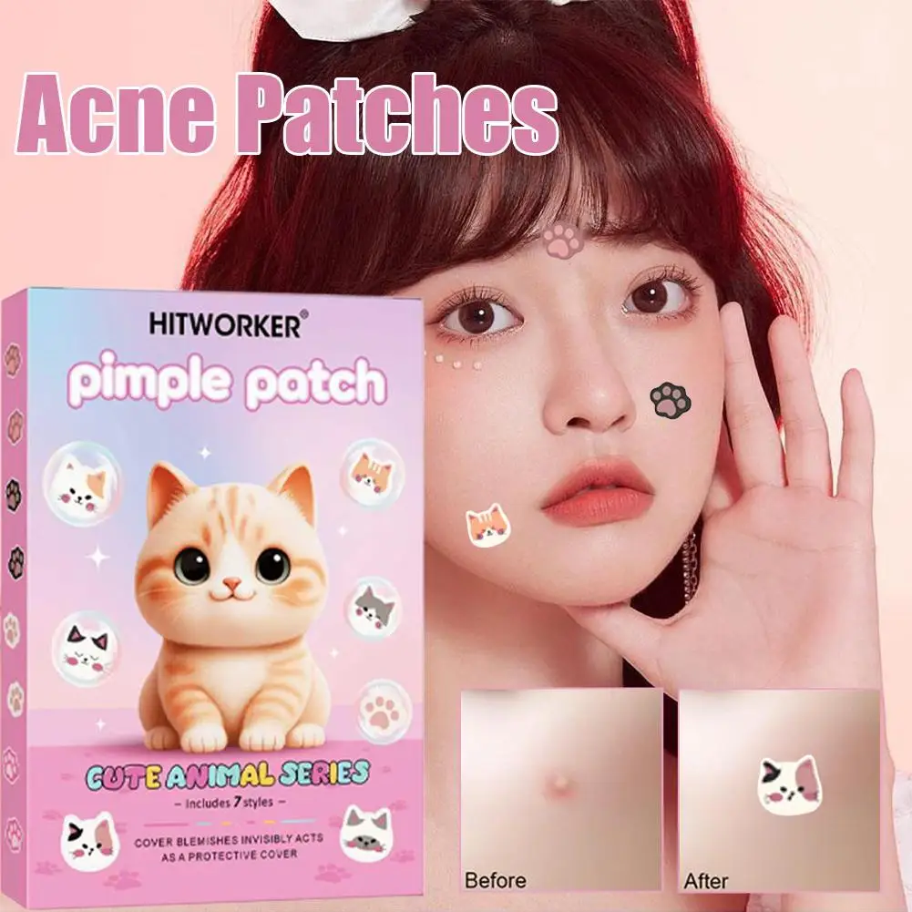 200 قطعة/المجموعة من بقع حب الشباب القط اللطيفة غير مرئية ومقاومة للماء وغير مهيجة ومناسبة لجميع أنواع البشرة 2026 جديد #2