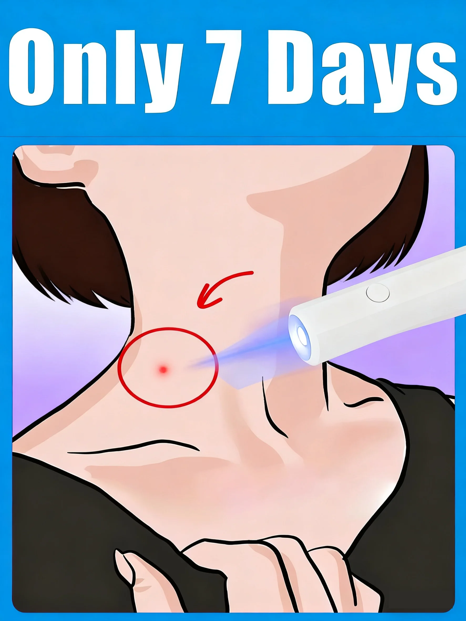 

Многофункциональная ручка для удаления бородавок с синим светом, портативная легкая ручка для домашнего использования, нежный уход за кожей, унисекс, горячая распродажа ​