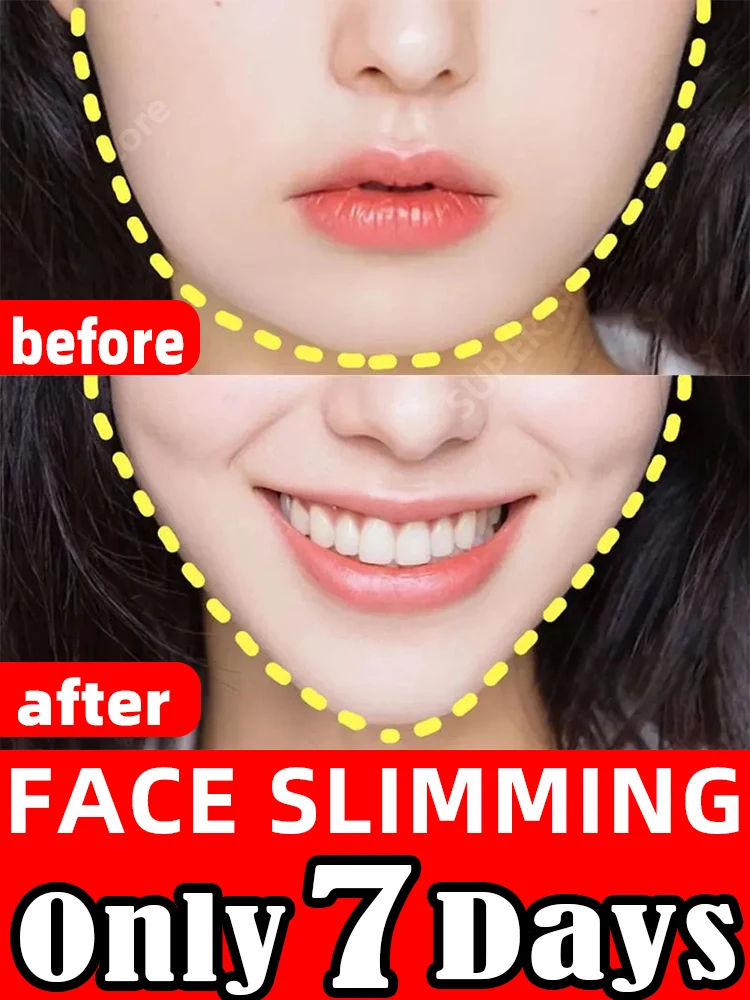 

Remove double chin v lifting