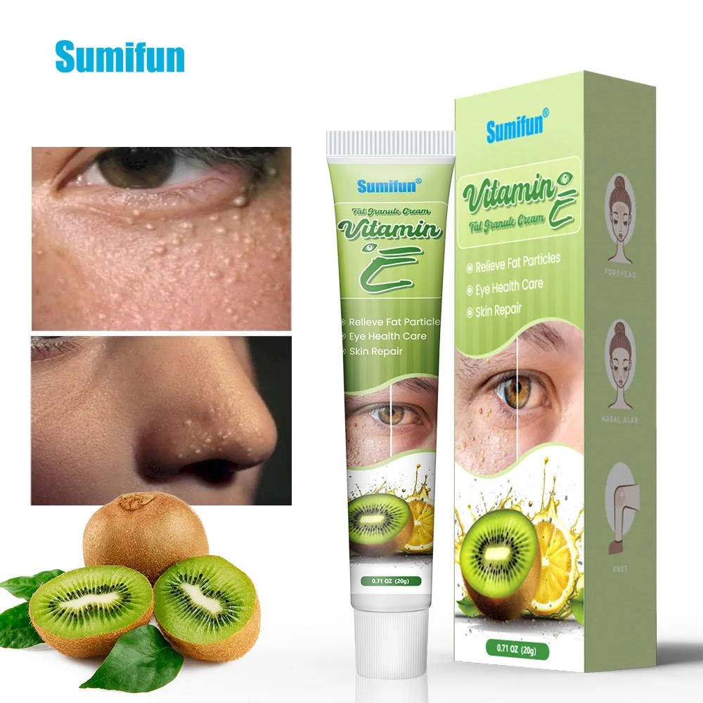 Fat Granules Remover Eye Cream Effective Remove Fat Granules Puffiness Anti-Particles Milia Remover Product Repair Eye Skin Care
