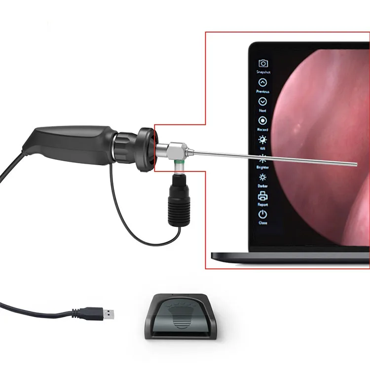 ENT Endoscope Medical Cheap Price Portable Flexible Rigid 0 Degree ENT Endoscope Camera