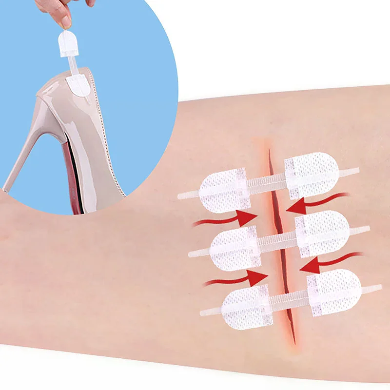 

3Pcs Zipper Tie Wound Closure Patch Hemostatic Patch Wound Fast Suture Zipper Band-Aid Outdoor Portable Skin Care