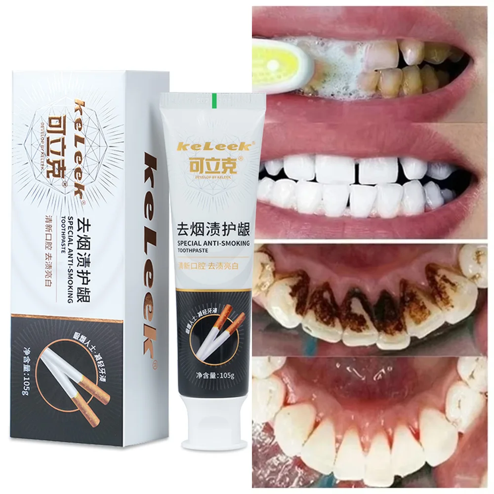 Teeth Whitening Toothpaste Remove Smoke Stains Cleaning Oral Fresh Breath Bleaching teeth Dental Tools fresh breath keleek